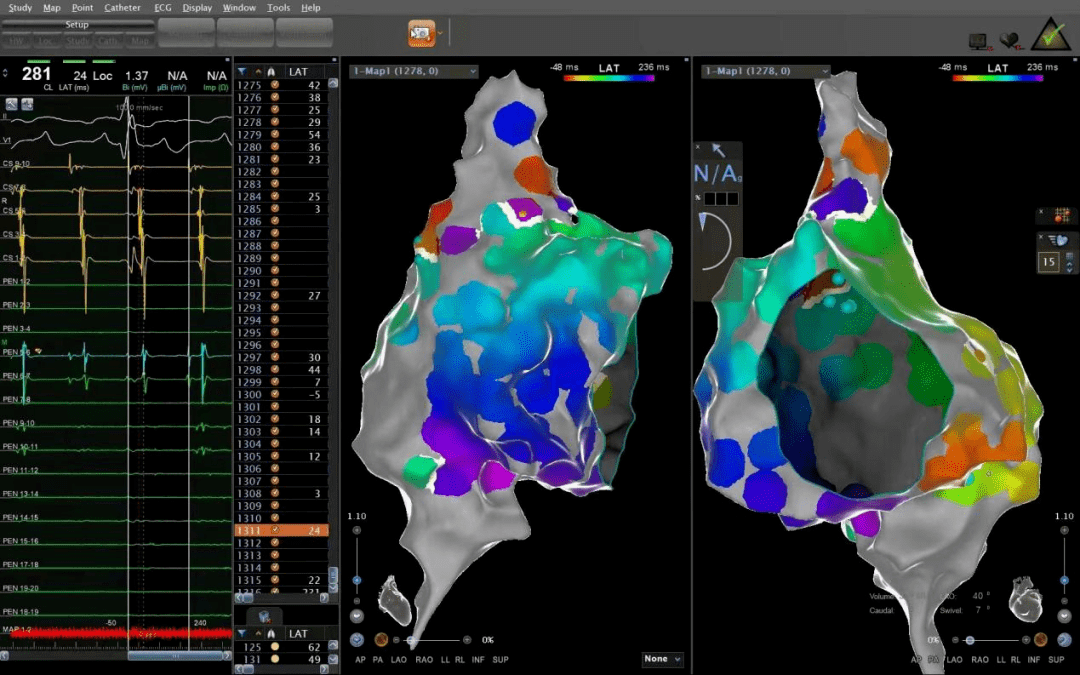 陕鼓：聚焦“空气充电宝”与“碳捕集心脏”突破引领绿色能源转型